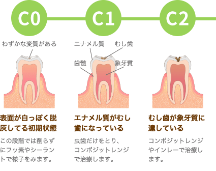 C0-C1-C2